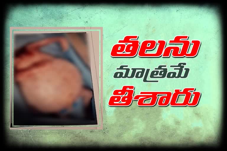 Achchampeta Government Hospital doctors Neglect Negligence in Nagar Kurnool District