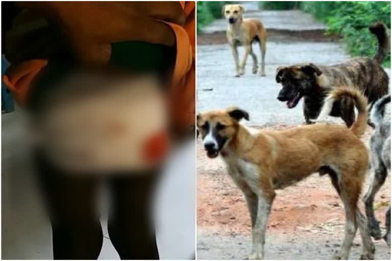 Dogs bitten many people, news of Koderma, latest news of Jharkhand, Koderma Nagar Panchayat, कुत्तों ने कई लोगों को काटा, कोडरमा की खबरें, झारखंड की ताजा खबरें, कोडरमा नगर पंचायत