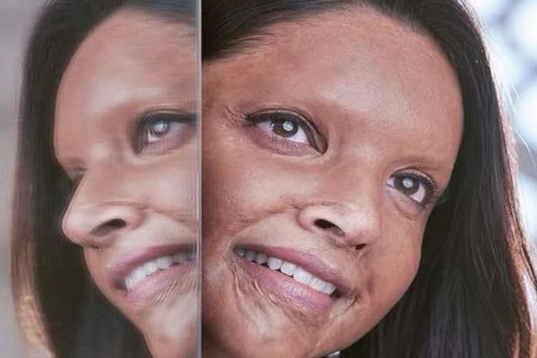 deepika padukone chhapaak