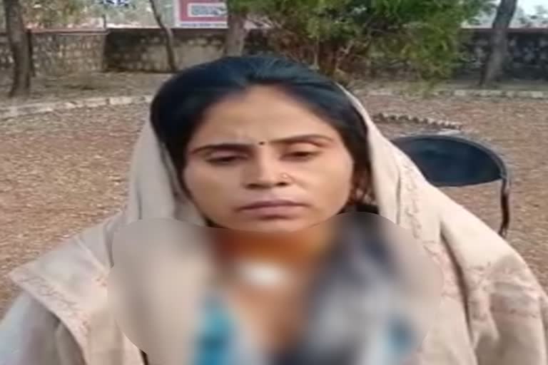 बारां की खबर,  bara news,  बस में महिला पर हमला,  Attack on woman in bus