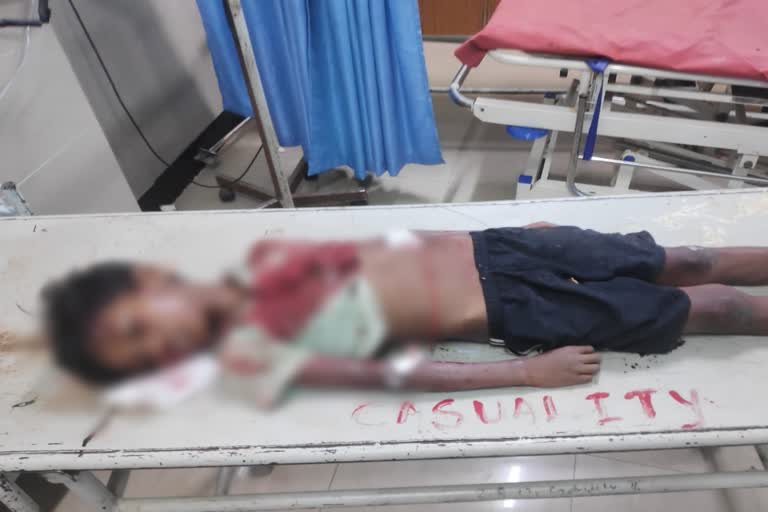 ಬಾಲಕ ಸಾವು, Boy died in Shimoga as iron rod fell on him