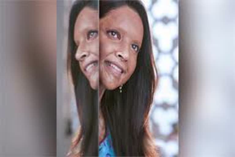 Chhapaak controversy