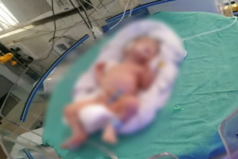 new born baby in Nuh civil hospital