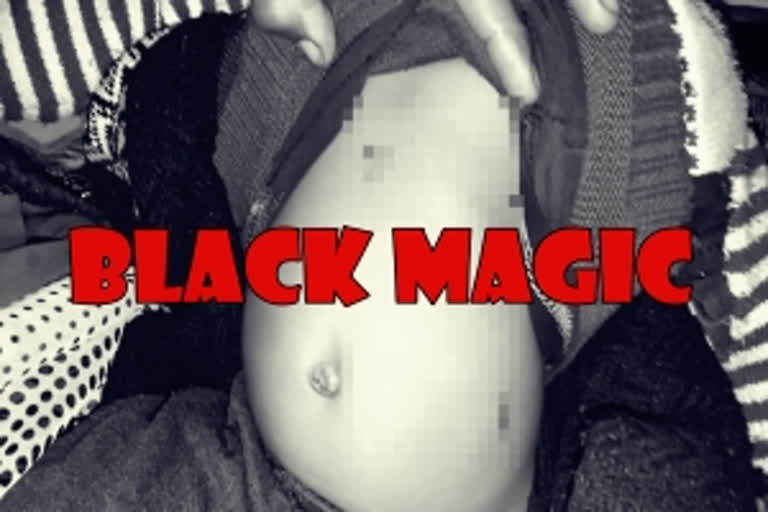 Black magic  Chhatrarpur  Madhya Pradesh  burn injuries  മന്ത്രവാദ ചികില്‍സ  ആറുമാസം പ്രായമുള്ള കുഞ്ഞ് പൊള്ളലേറ്റ നിലയില്‍  മധ്യപ്രദേശ്