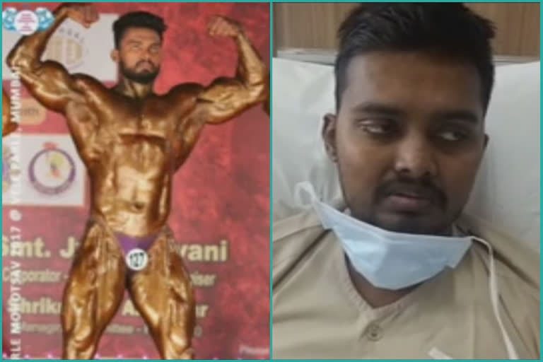 Both kidneys of a body builder from kurla failed due to taking exess artificial diet