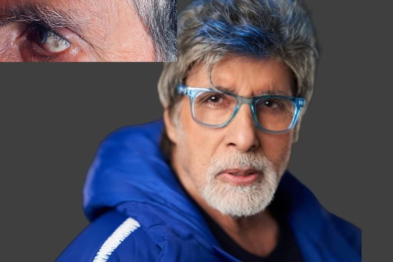 Amitabh Bachchan Visits Doctor Due to a Black Spot in His Left Eye