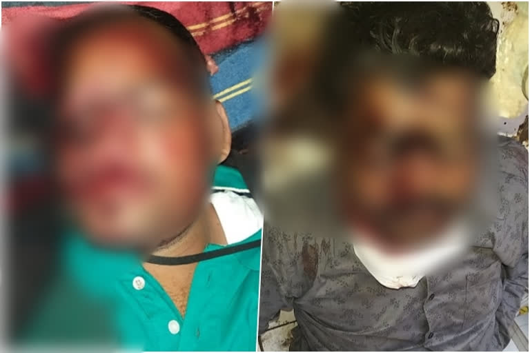 Collision between two bikes, Collision between two bikes in vijayapura, two riders died, two riders died in Vijayapura road accident, Vijayapura road accident news, ಎರಡು ಬೈಕ್​ಗಳ ಮಧ್ಯೆ ಡಿಕ್ಕಿ, ವಿಜಯಪುರದಲ್ಲಿ ಎರಡು ಬೈಕ್​ಗಳ ಮಧ್ಯೆ ಡಿಕ್ಕಿ, ಇಬ್ಬರು ಸವಾರರು ಸಾವು, ವಿಜಯಪುರ ರಸ್ತೆ ಅಪಘಾತದಲ್ಲಿ ಇಬ್ಬರು ಸವಾರರು ಸಾವು, ವಿಜಯಪುರ ರಸ್ತೆ ಅಪಘಾತ ಸುದ್ದಿ,