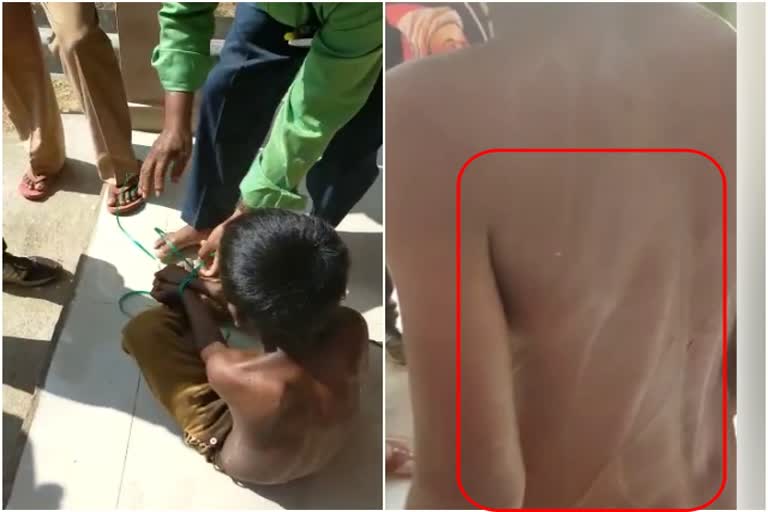 ಶಾಲೆಗೆ ಬಾರದ್ದಕ್ಕೆ ಶಿಕ್ಷಕನ ಮೃಗೀಯ ವರ್ತನೆ,  teacher assault on student at Karwar