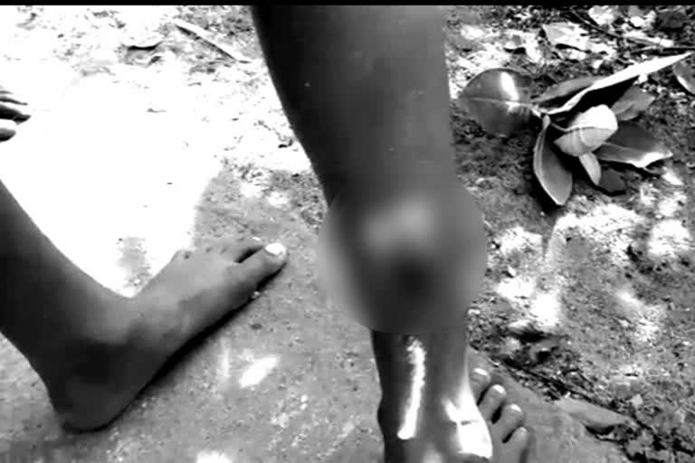 dog attack on five students in gudur