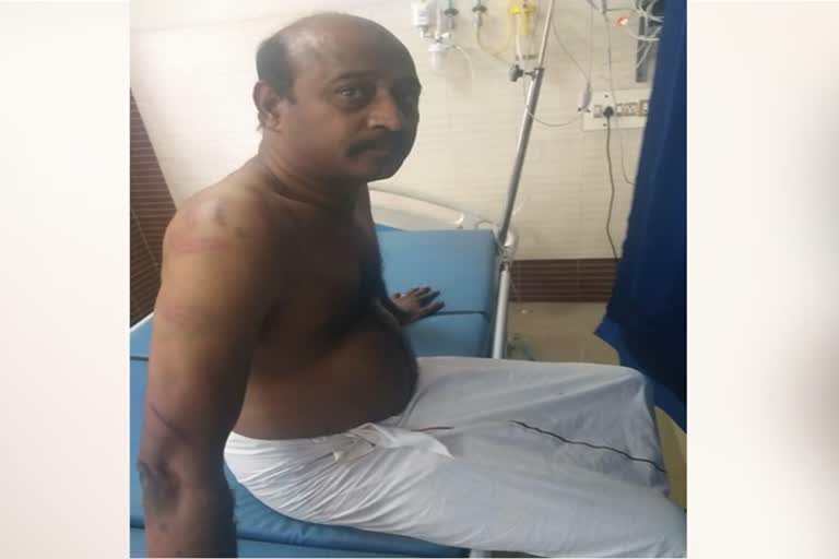 kovai-former-admk-member-assaulted-for-joining-dmk