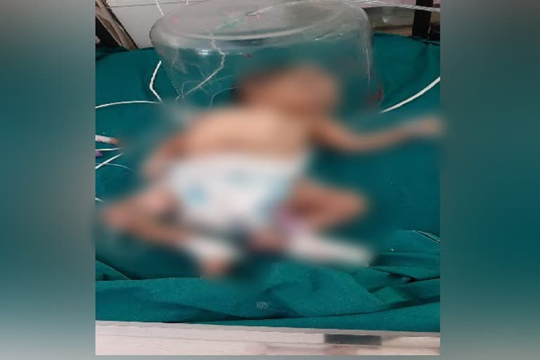 dog-run-with-newborn-baby-girl-having-long-wound-on-body-in-rajkot