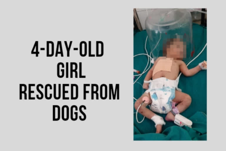 4-day-old infant girl rescued from dogs, critical