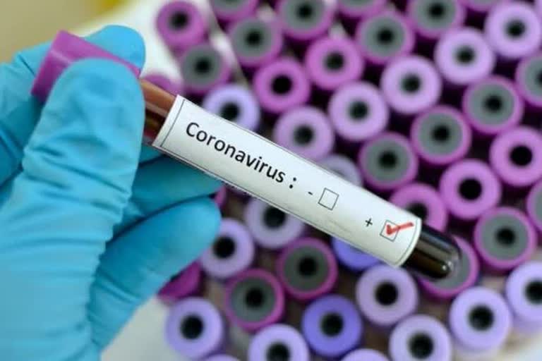 coronavirus