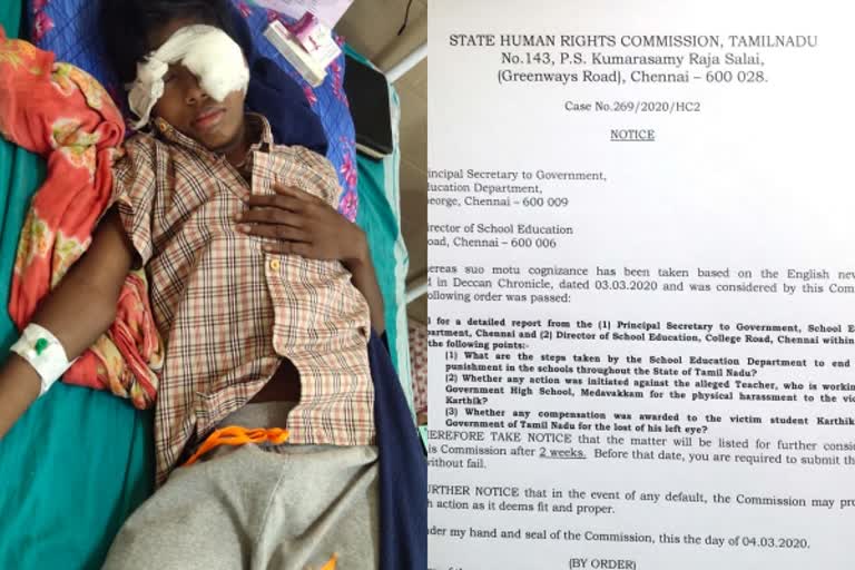 human rights commission send to notice education department student who beat the teacher and lost his eyesight issue