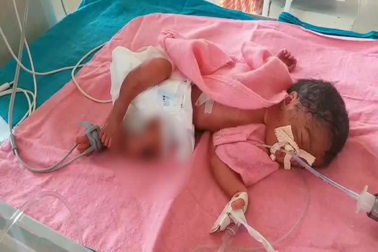 6-month-old girl, सड़क पर पड़ी मिली बच्च्ची