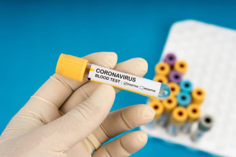 Coronavirus