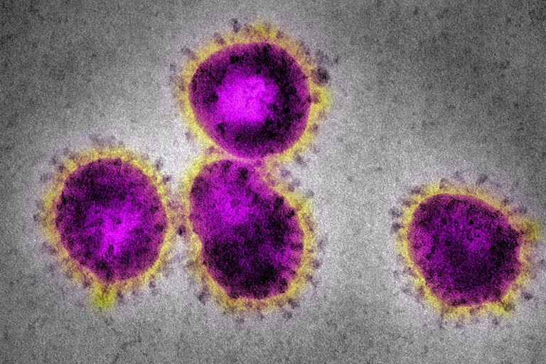 Coronavirus: 112 released from ITBP quarantine facility in Delhi Coronavirus cases rise to 81 in India