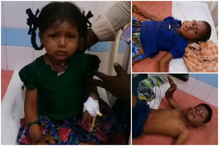 Angawadi children suffered with burns in kurnool