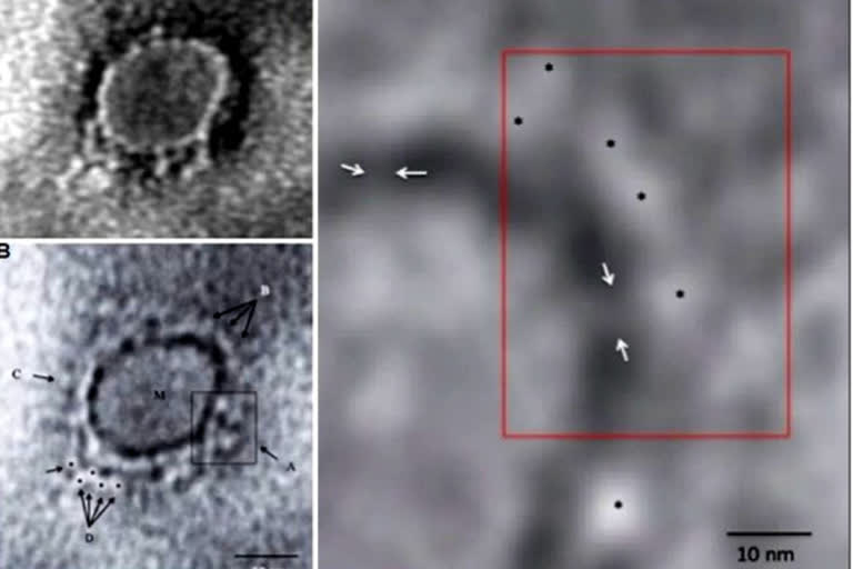 SARS-CoV-2 virus  microscopic image of COVID-19  novel coronavirus  Indian Journal of Medical Research  കൊറോണ വൈറസിന്‍റെ സൂഷ്‌മചിത്രം പുറത്ത് വിട്ട് ഇന്ത്യന്‍ ശാസ്‌ത്രജ്ഞര്‍  ഇന്ത്യന്‍ ശാസ്‌ത്രജ്ഞര്‍  കൊറോണ വൈറസ്  സാര്‍സ് കൊവ്‌-2