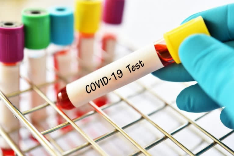 Indian Government Clarified When should you get a test for COVID19? and Released a list of testing labs