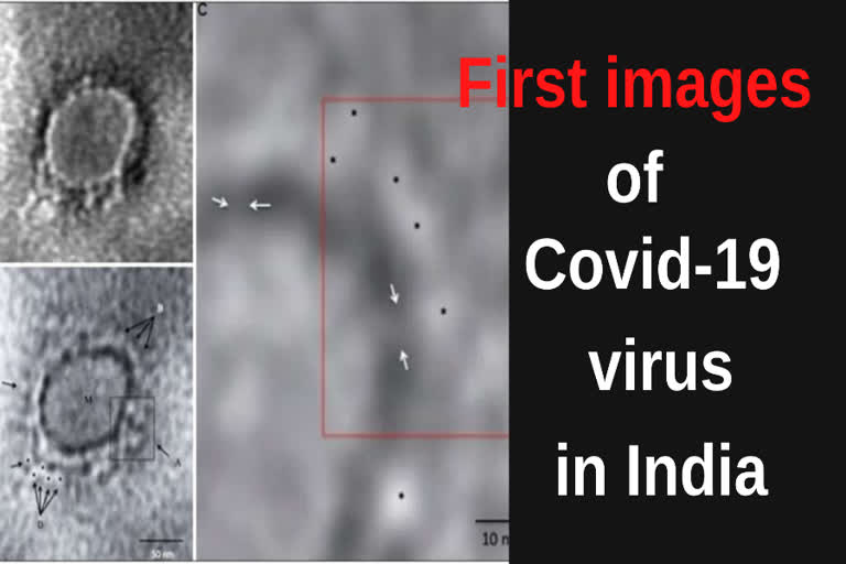 First images of Covid-19 virus in India released