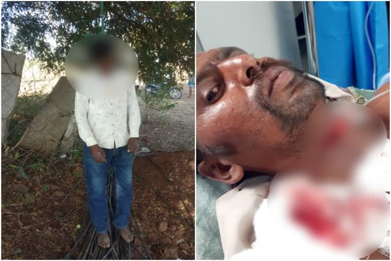 drinker-died-in-kolar-district-because-of-not-getting-drink