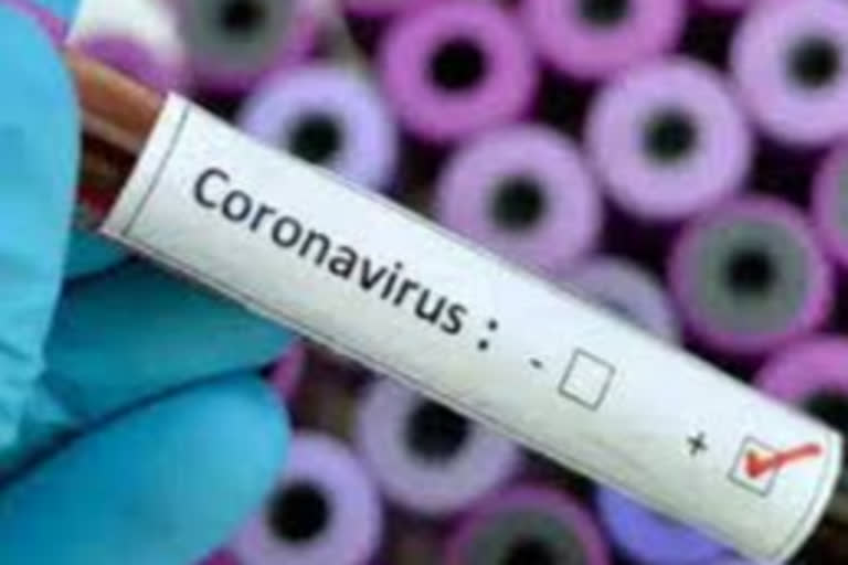 Coronavirus  positive