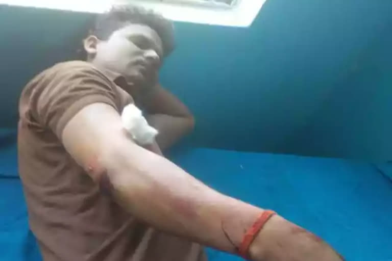 firing between children's fight, injured a teenager in kaimur bihar