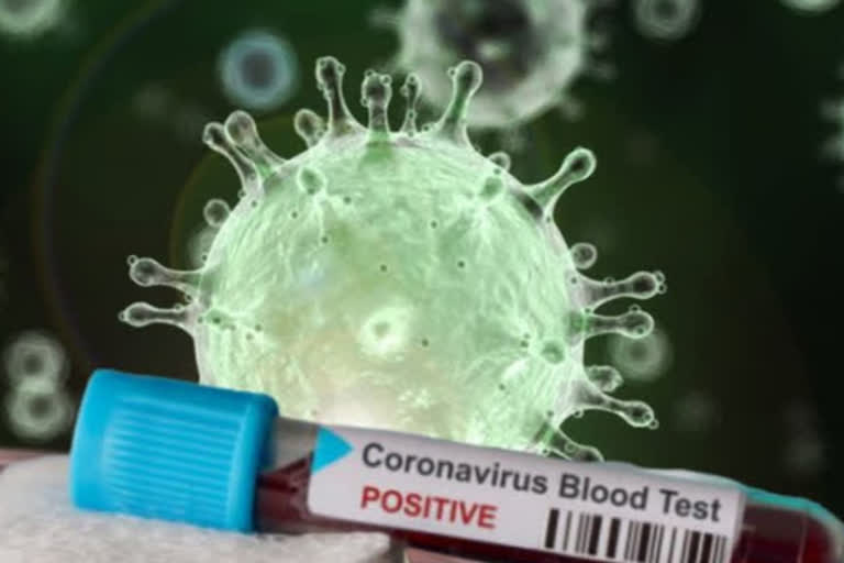 COVID-19\  prisoners  Bombay High Court t  bail  coronavirus  കൊവിഡ് 19  കൊവിഡില്‍ എംപിഐഡിയില്‍ കേസെടുക്കുന്നവര്‍ക്ക് ജാമ്യമില്ല  കൊറോണ വൈറസ്