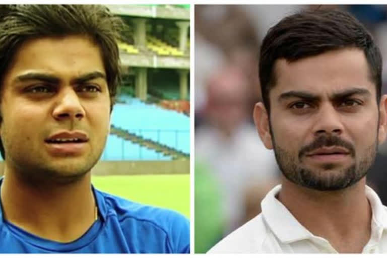 one big turning point, virat kohli realized, kohli was slightly overweight,  paddy upton, ବିରାଟ କୋହଲି, ଓଜନ ଅଧିକ ଥିବା ହୃଦବୋଧ କରିବା, କୋହଲିଙ୍କ ପାଇଁ ଟର୍ଣ୍ଣିଂ ପଏଣ୍ଟ, ପ୍ୟାଡି ଅପଟନ