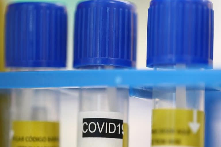 ICMR conducts over 1.6 lakh tests for COVID-19