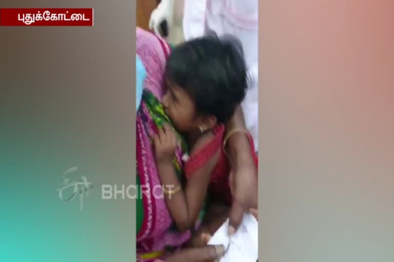 Pudukottai doctor remove the kolusu ball from 3 year old child