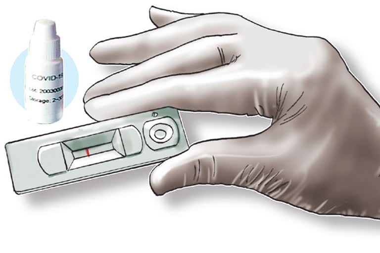 coronavirus testing kit