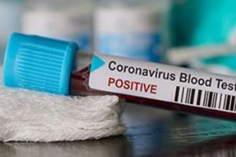 coronavirus