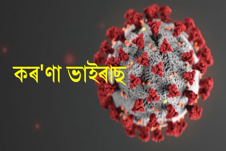 প্ৰথম কোন আহিছিল? মানুহ নে ভাইৰাছ ?