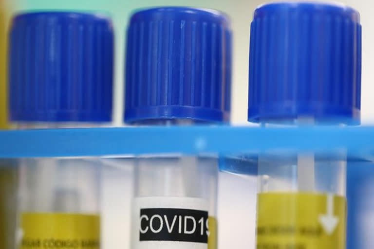 remdesivir  COVID-19  Corona drug  COVID-19 medicine  Gilead Sciences  Dr Anthony Fauci  Donald Trump