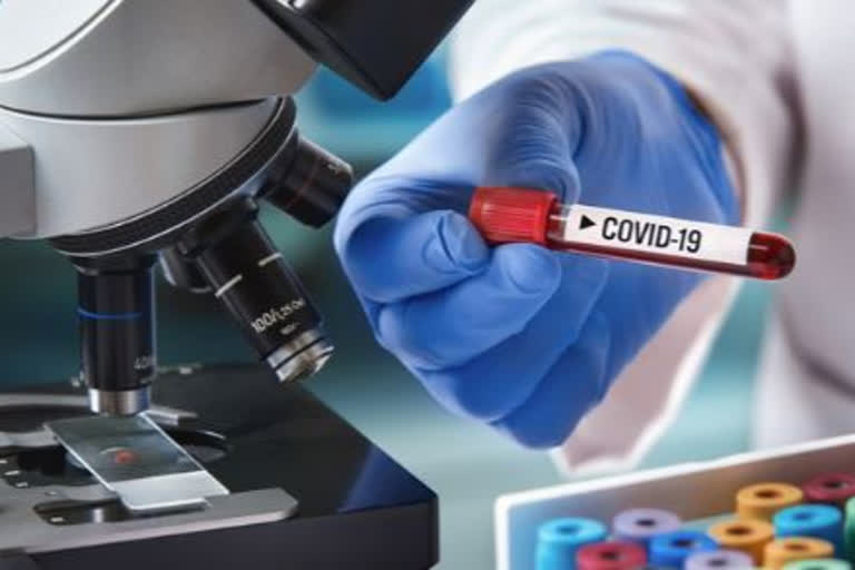 71 new COVID-19 cases reported in AP; number goes up to 1,403 in state