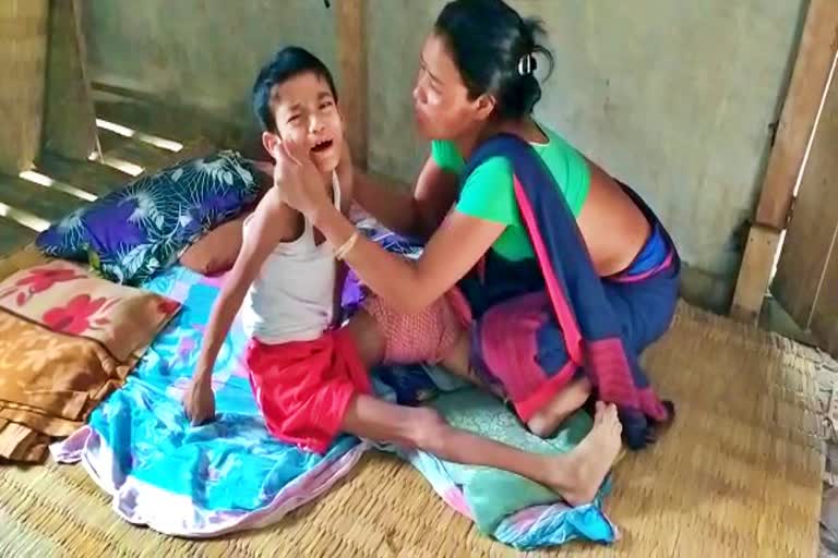 A child of a poor family fighting with cancer in majuli