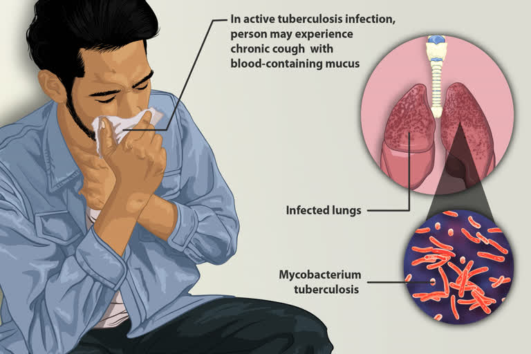 TB Mortality may increase in India due to COVID-19 pandemic