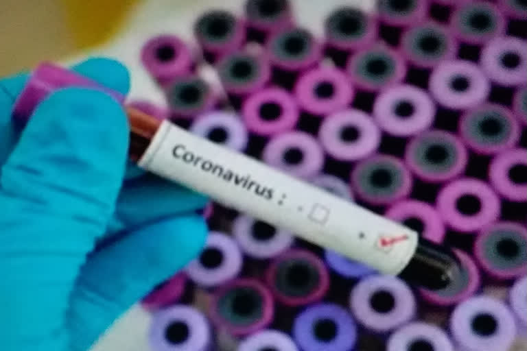 2 more police stuff infected with covid-19 virus in kolkata