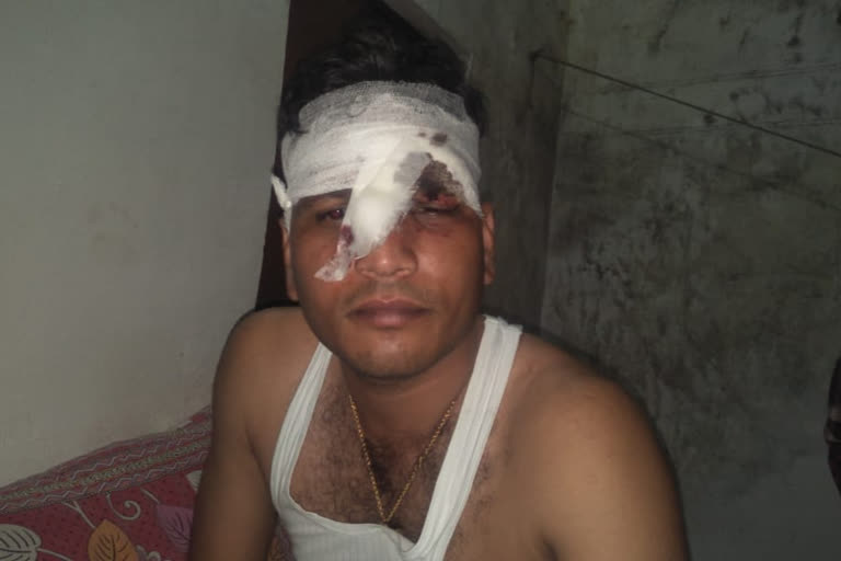 jalaun police personal injured in stone pelting