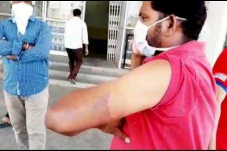 Case registered against policemen beating officer in Neemuch