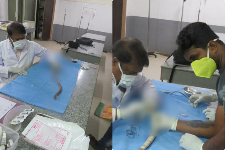 Watch: forest department doctor made surgery to wounded snake