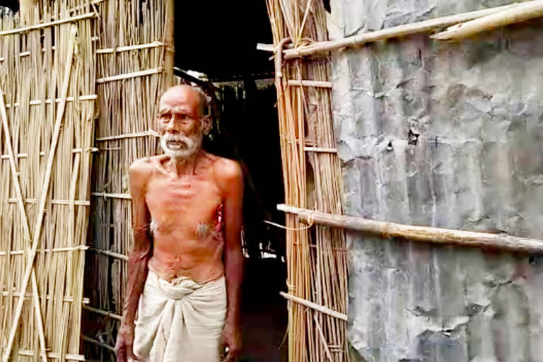 pathetic condition of a old aged couple in kalaigaon