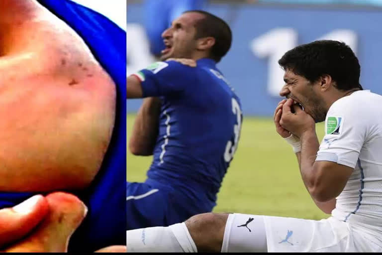 Chiellini, Suarez