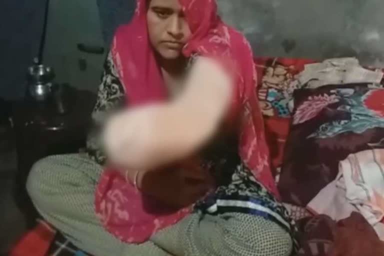 Infections in woman's hand after injection during delivery in tohana fatehabad