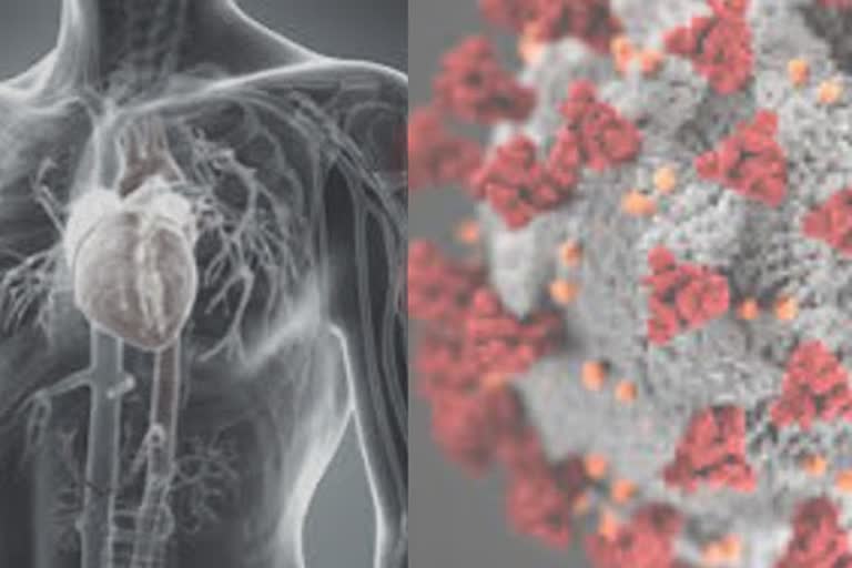 COVID-19-induced cardiovascular complications