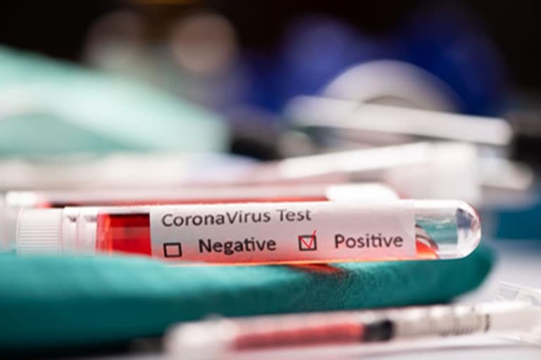 China reports 36 new coronavirus cases