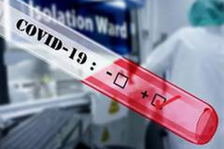 Kashmir's senior doctor tests positive for Covid-19