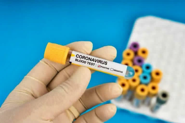 coronavirus  coronavirus test  Vishvendra Singh  RTDC  negative COVID reports show positive  Bharatpur Medical College  രാജസ്ഥാനിൽ കൊവിഡ് പരിശോധനാ ഫലത്തിൽ തെറ്റ്